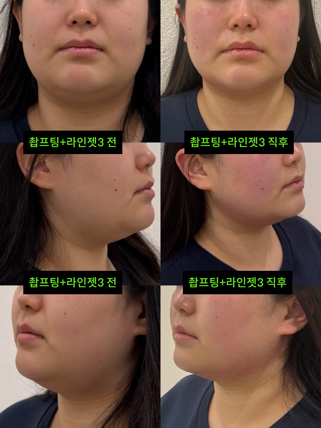 거래처 셀렉 제품 5