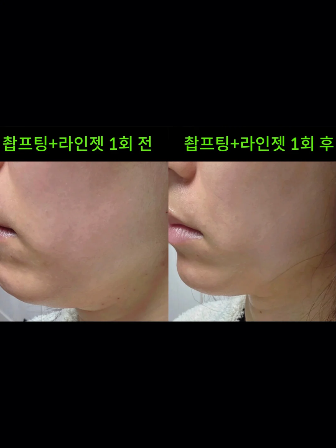 거래처 셀렉 제품 6