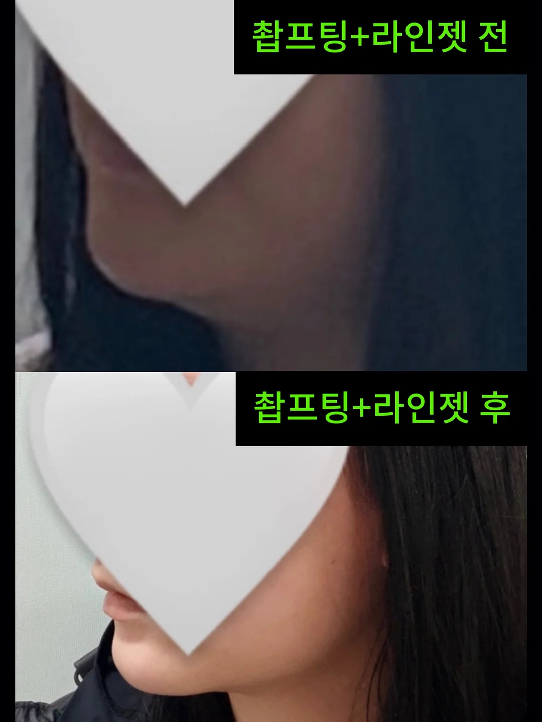거래처 셀렉 제품 7