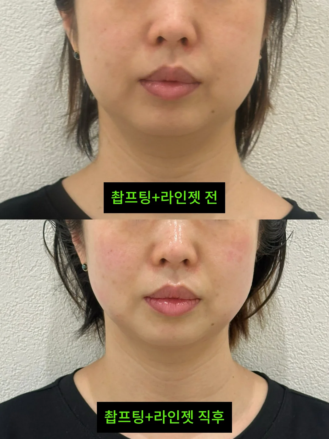 거래처 셀렉 제품 8