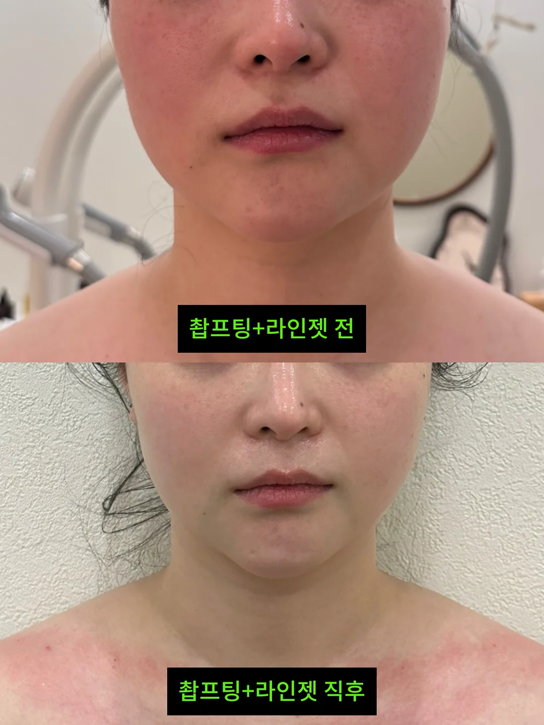 거래처 셀렉 제품 9