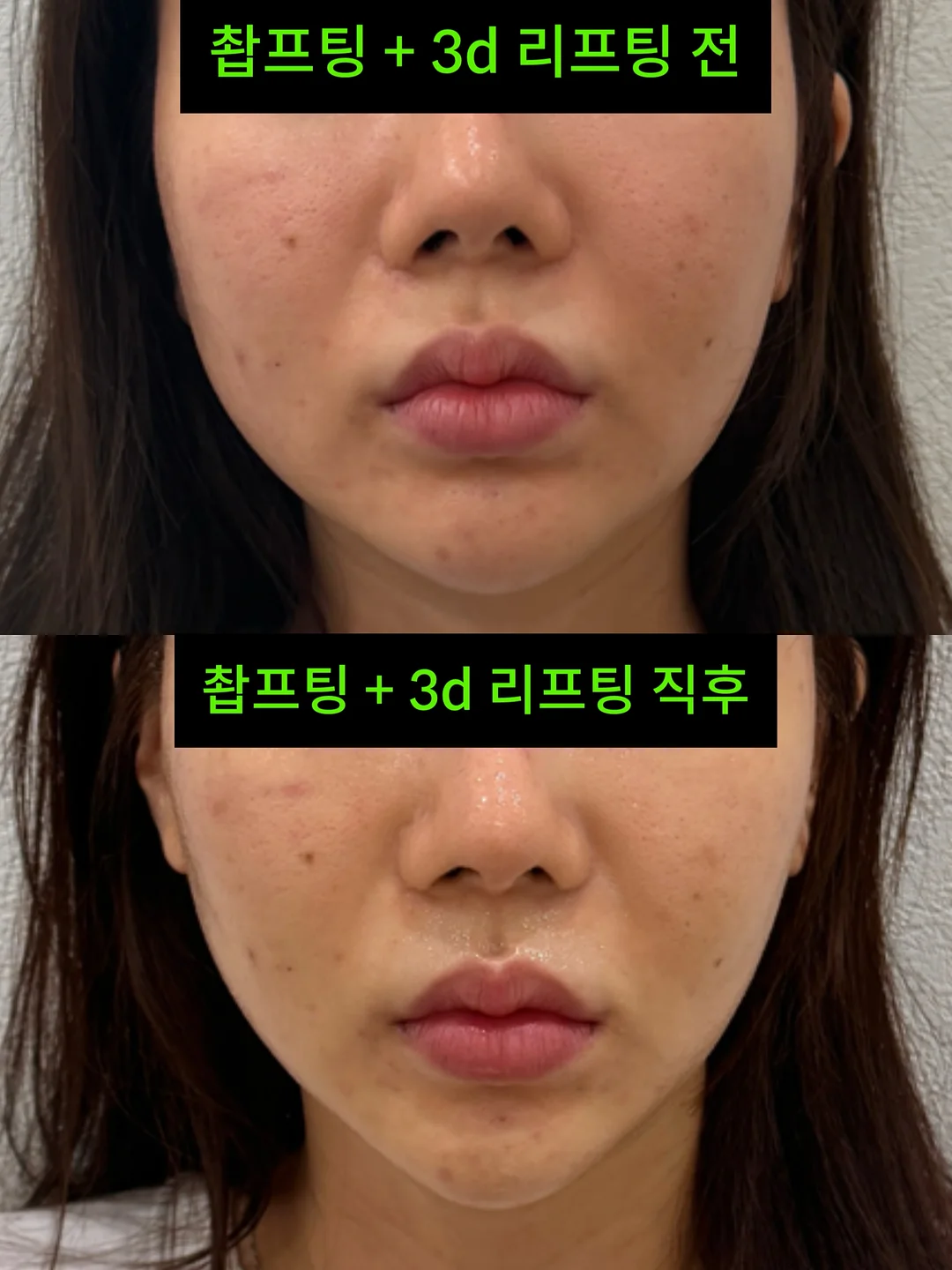 거래처 셀렉 제품 10