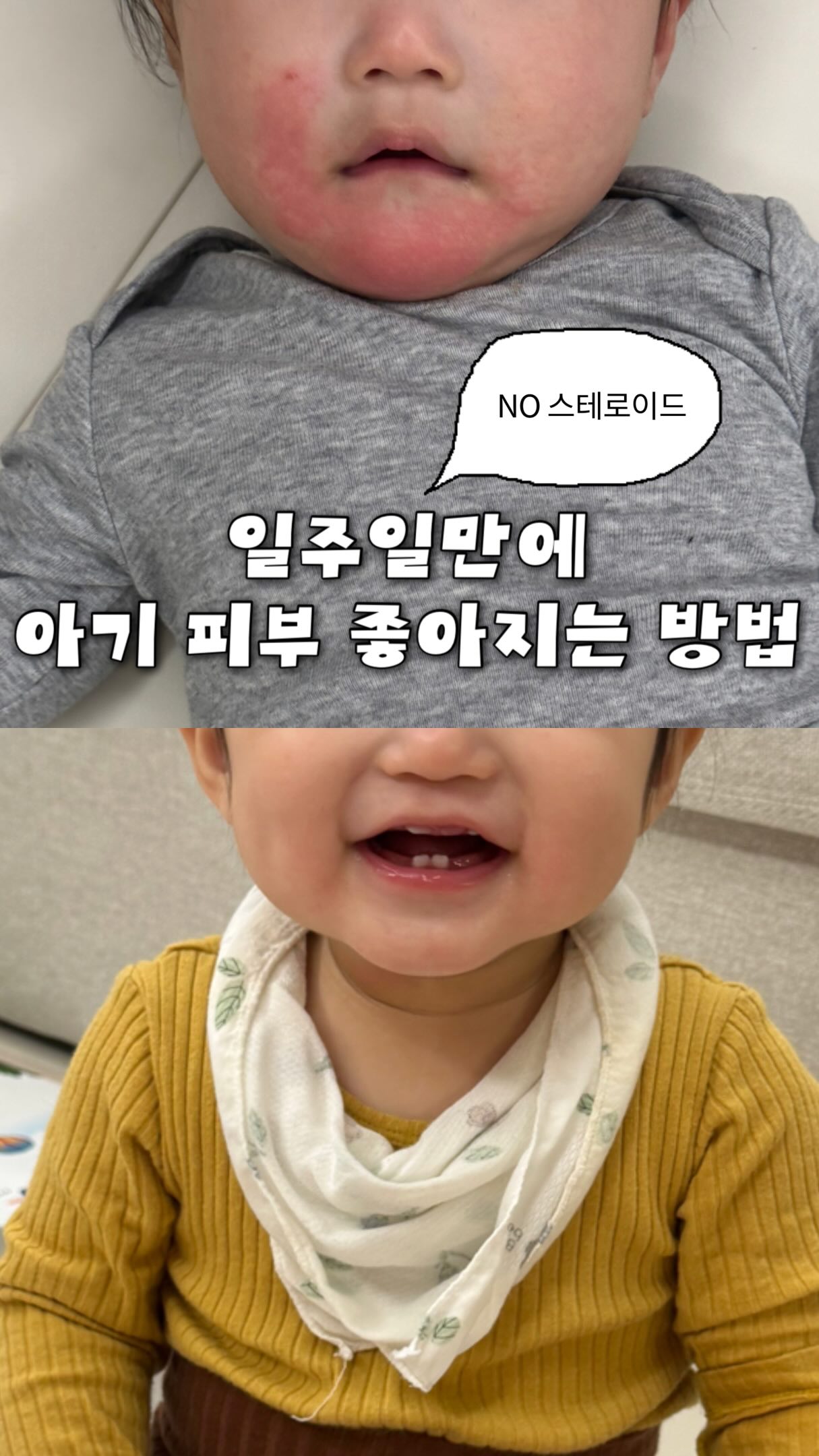 홈런스타 메론