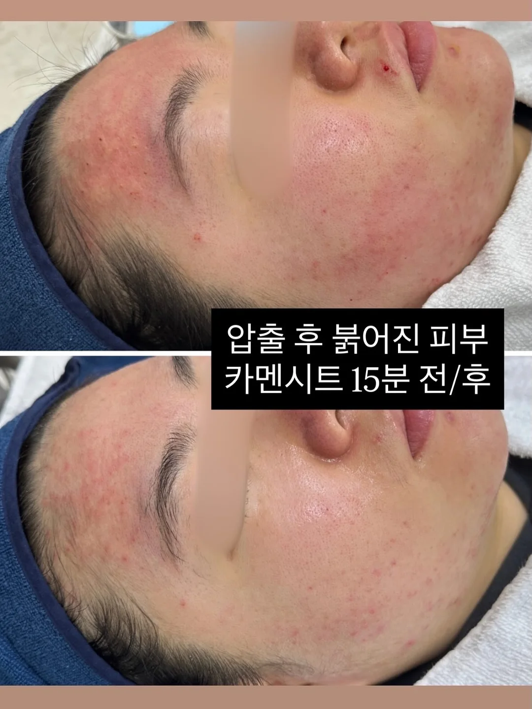 청바지 13