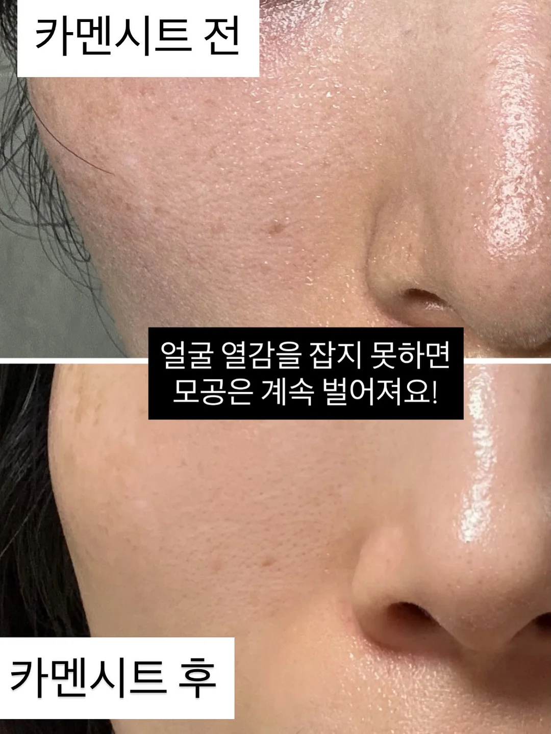 청바지 2
