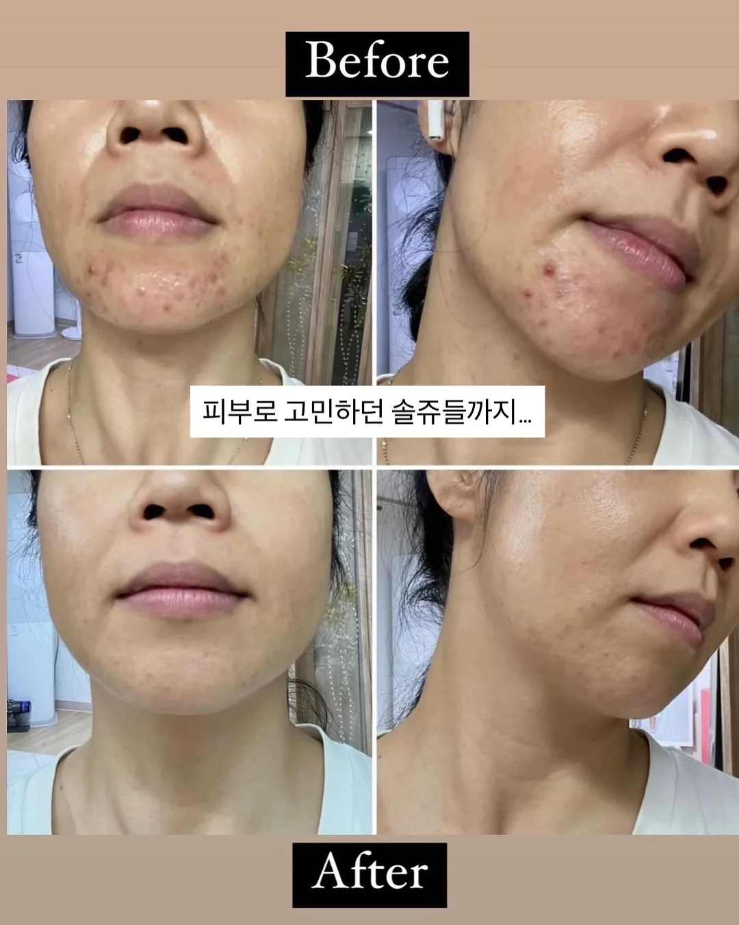 크로셰 가디건 12