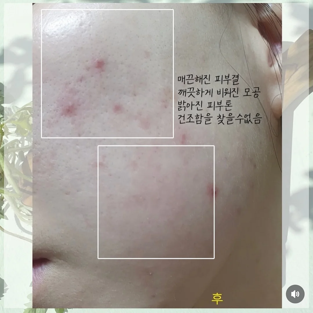 엑소메라 미백세럼 + 미백크림 11