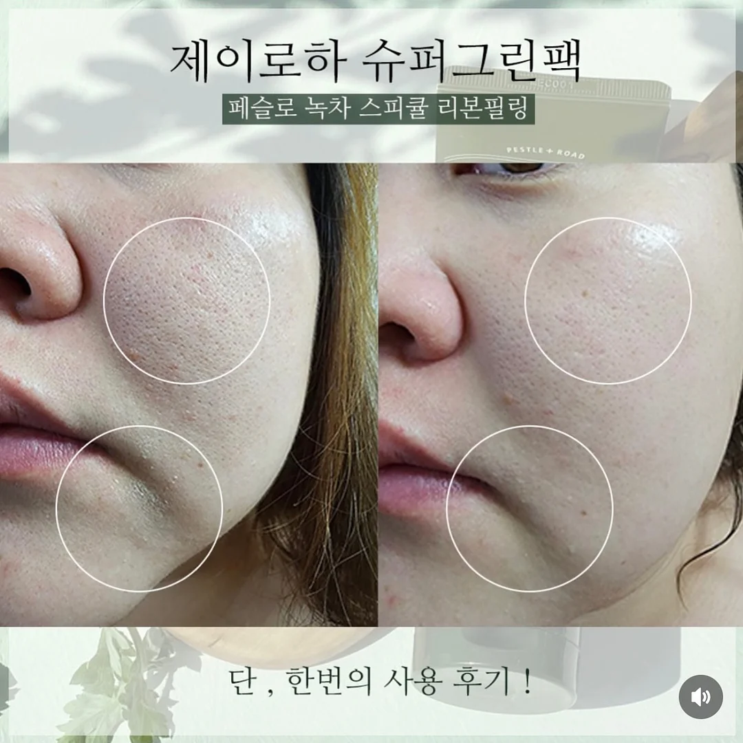 엑소메라 미백세럼 + 미백크림 4