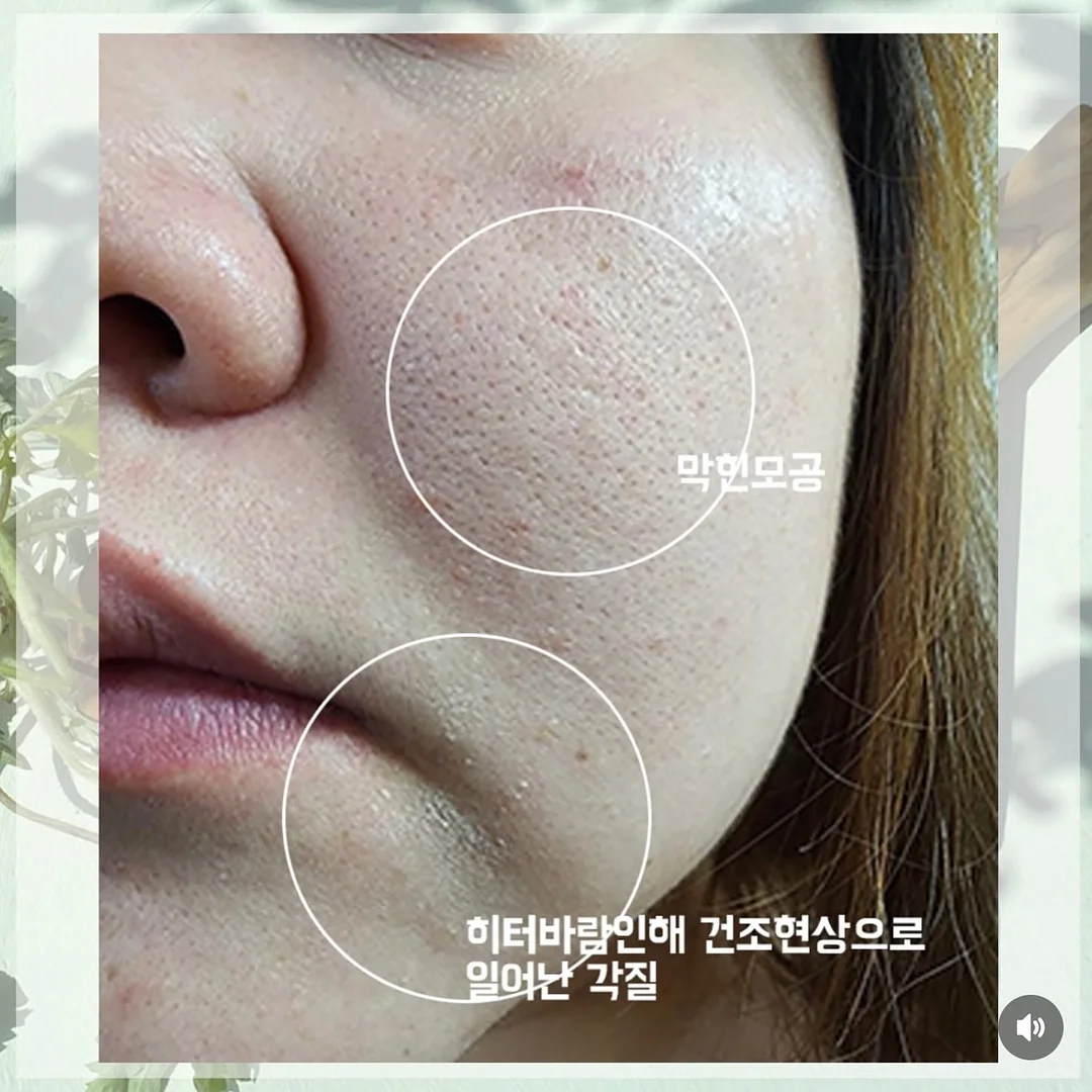 엑소메라 미백세럼 + 미백크림 5