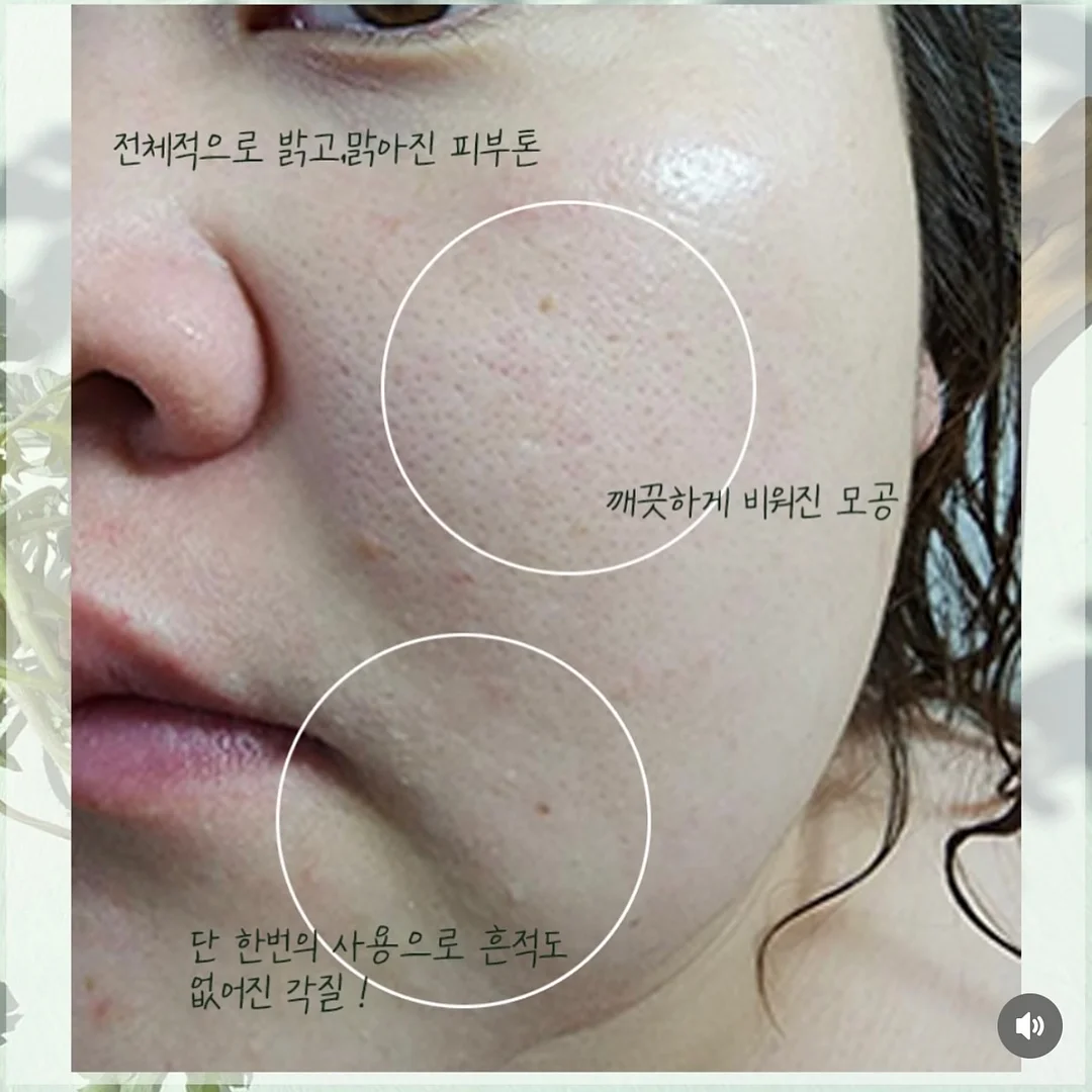 엑소메라 미백세럼 + 미백크림 6
