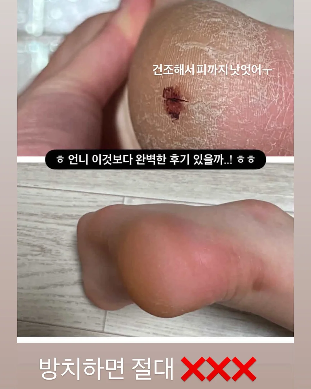 우이로우 클래스 17