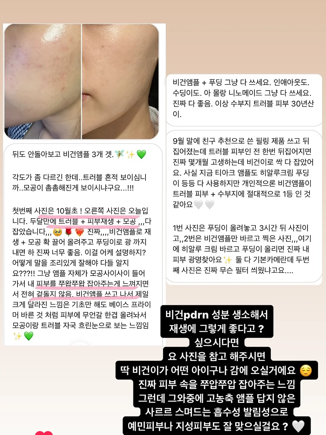 젠더의 경계를 넘는 아이들 2
