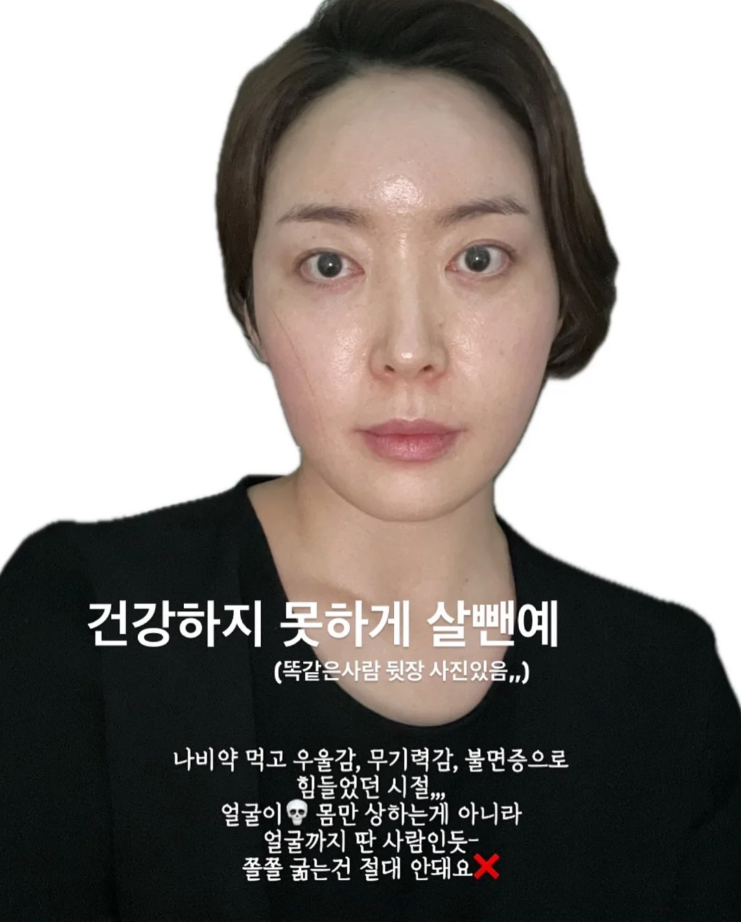 머즈캐리어 1