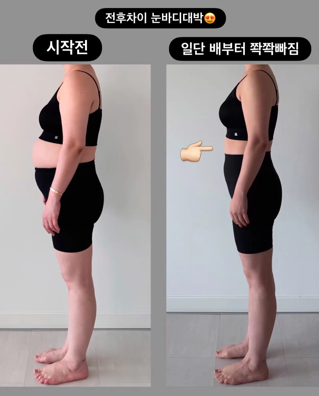 머즈캐리어 9