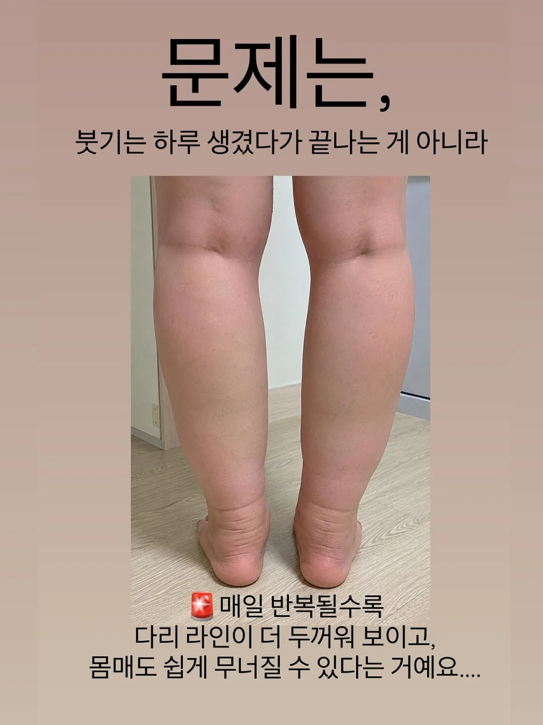 반창고 핀버튼 1