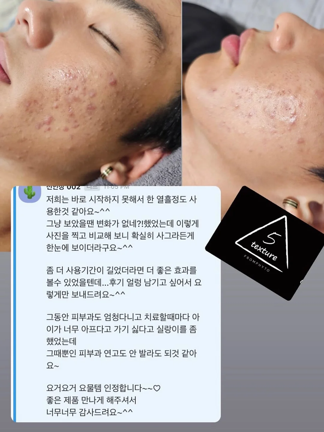 가디건 18
