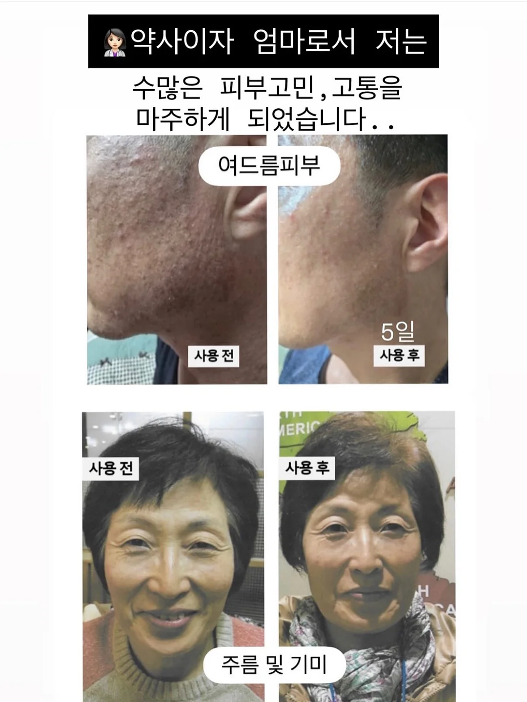 가디건 2