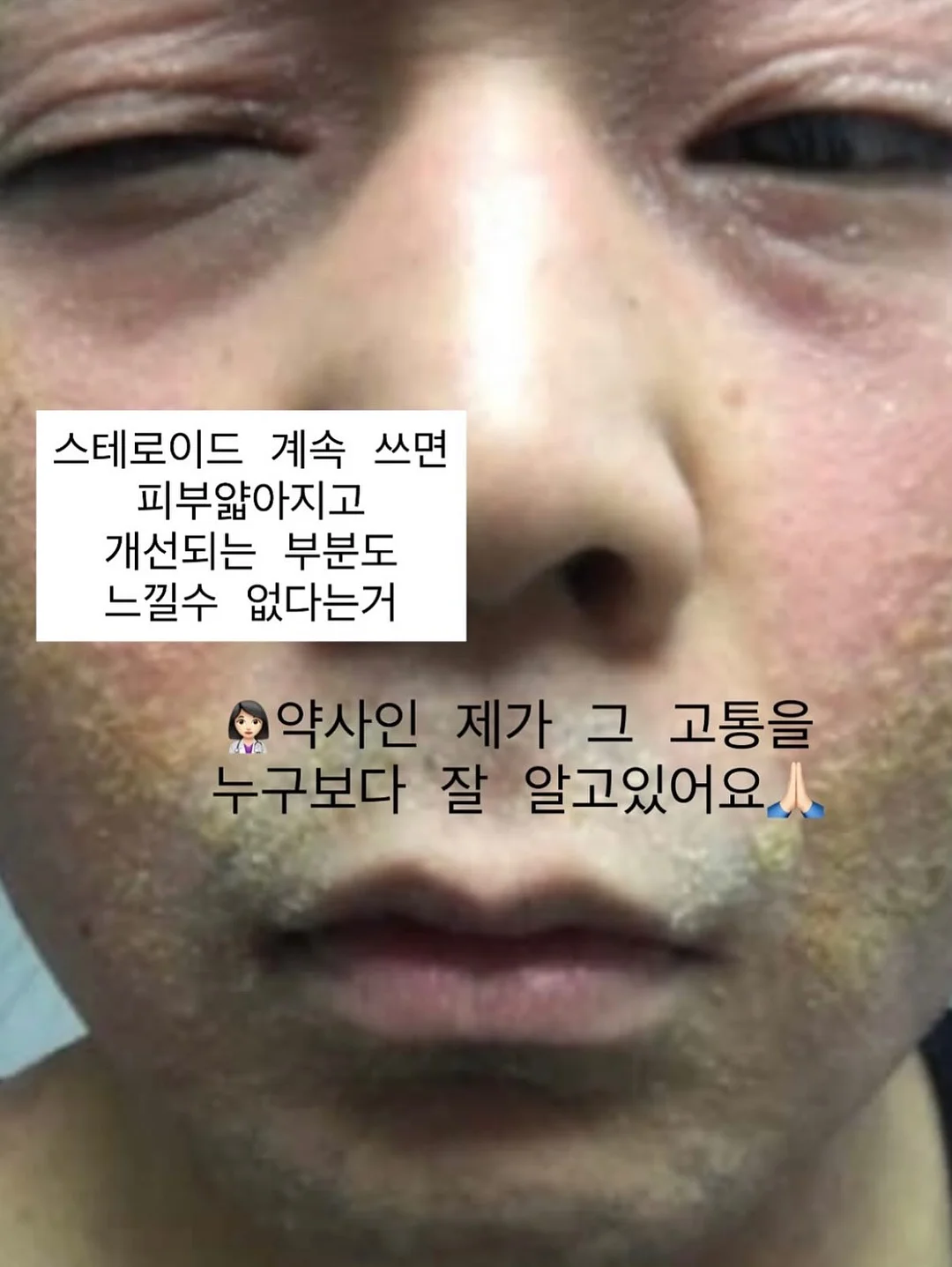 가디건 5