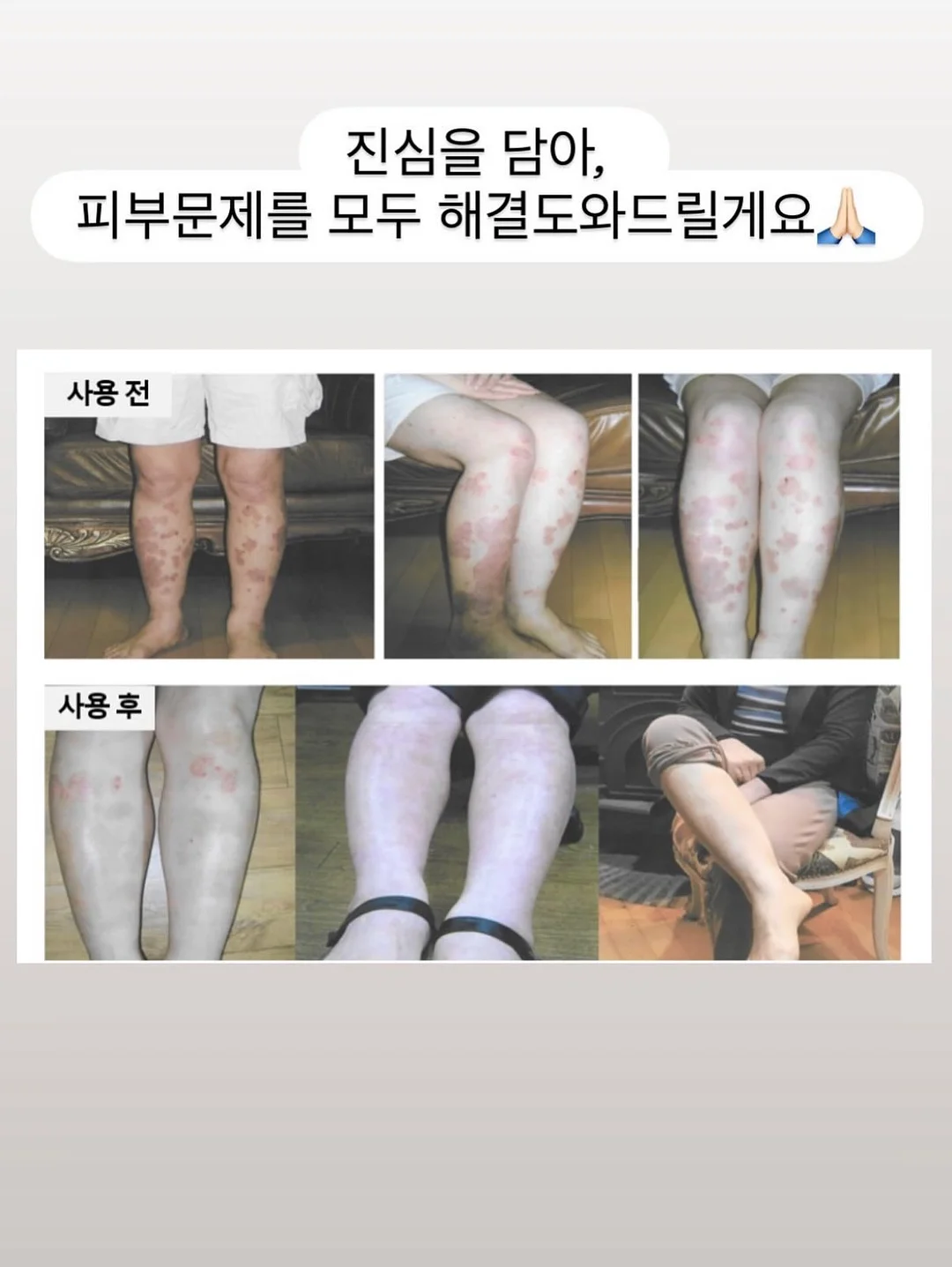 가디건 10
