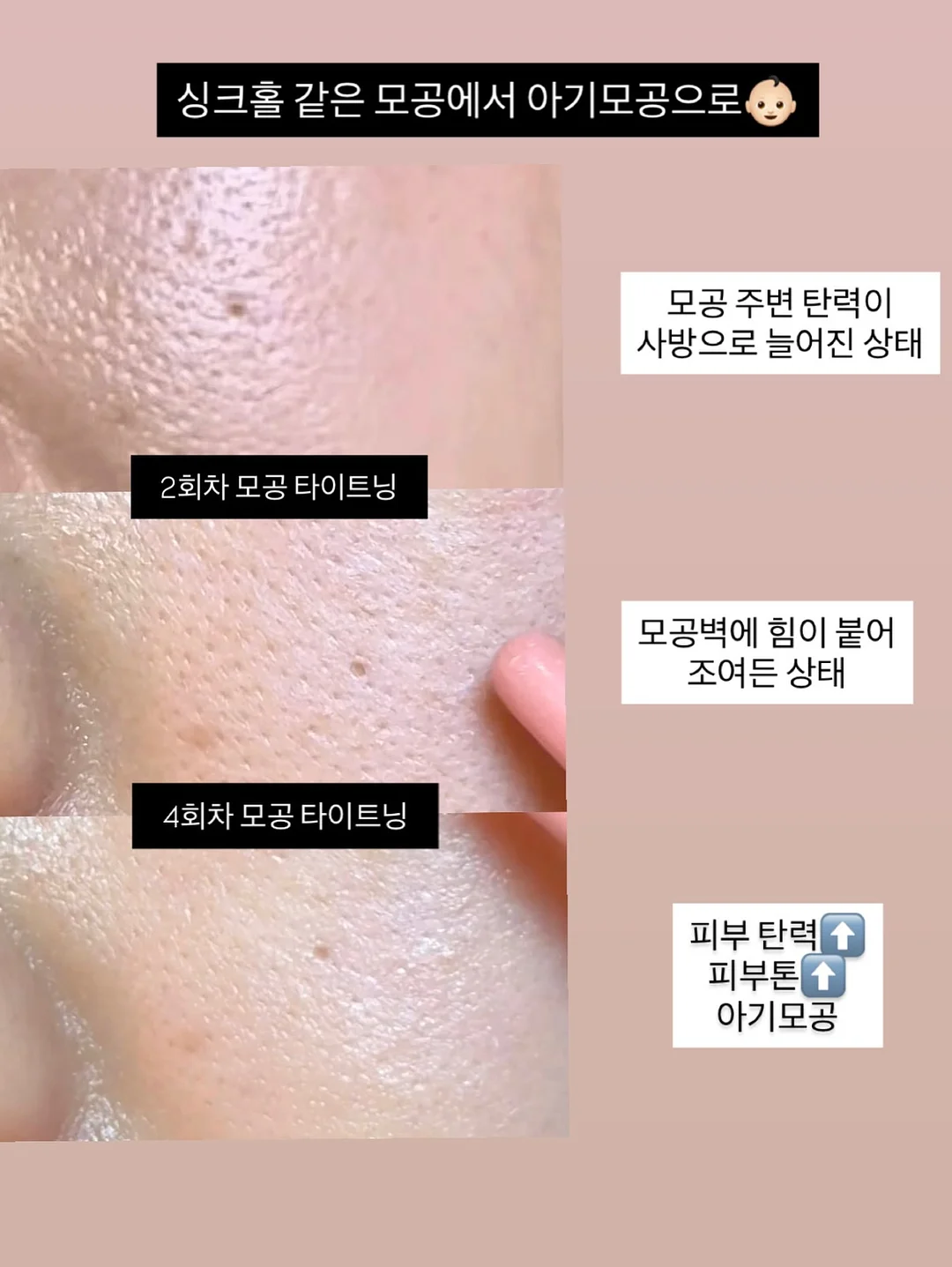 꼼데 울 라운드 반팔 가디건 1