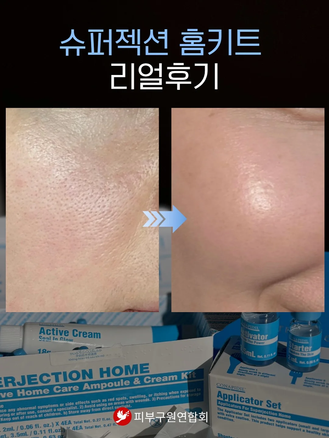 꼼데 울 라운드 반팔 가디건 17