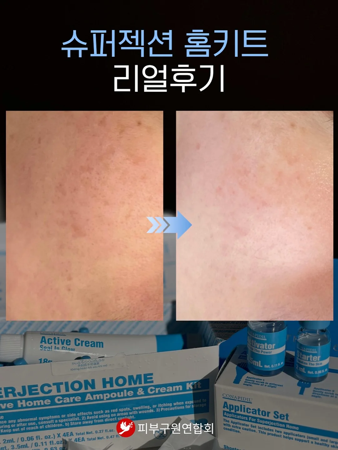 꼼데 울 라운드 반팔 가디건 18
