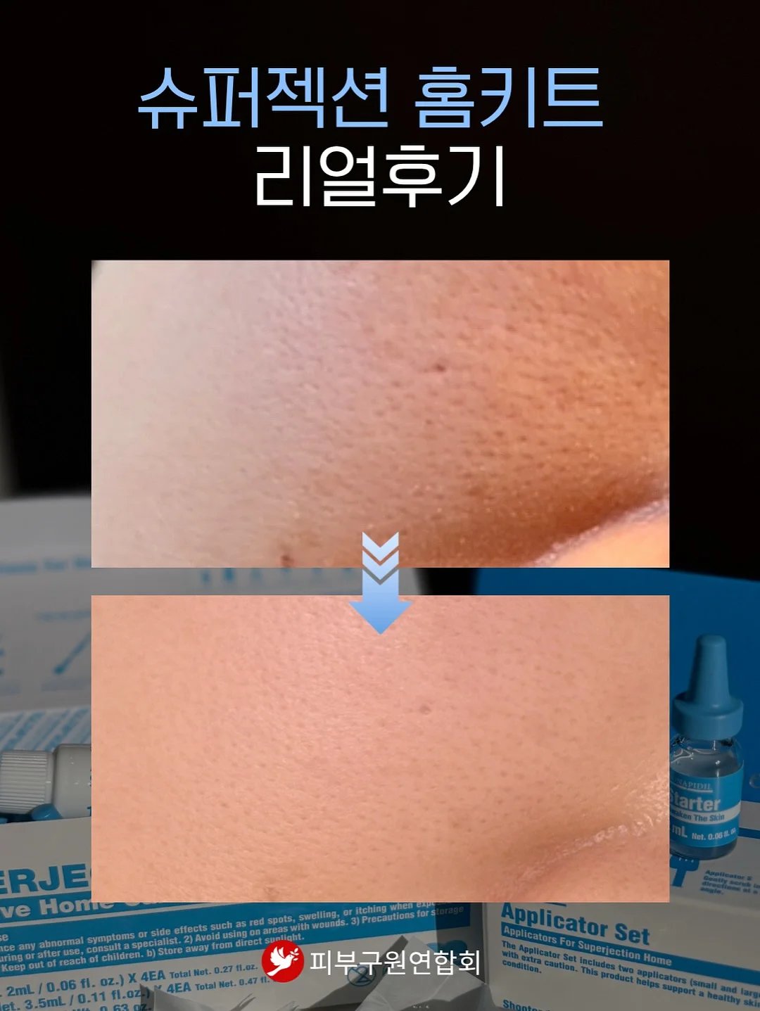 꼼데 울 라운드 반팔 가디건 19