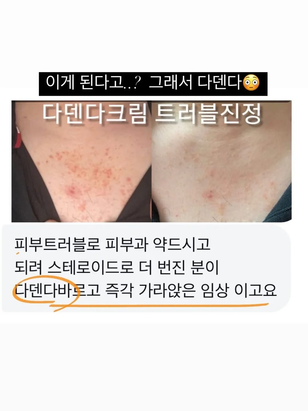잘크톤 츄어블 3