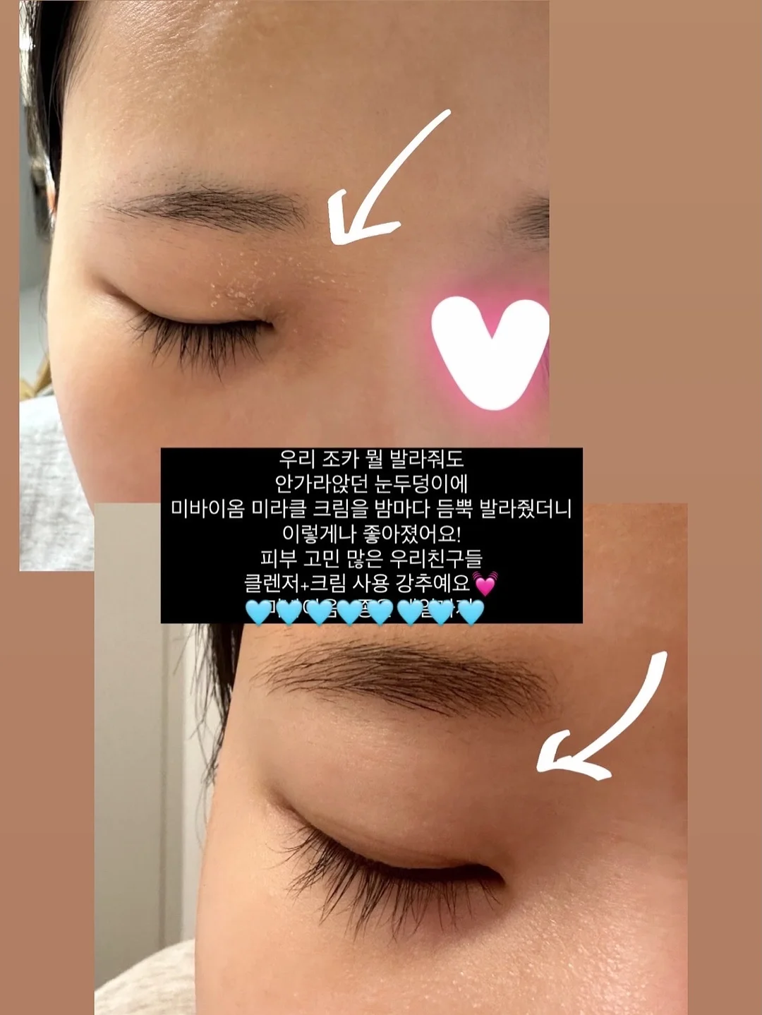 나시 18