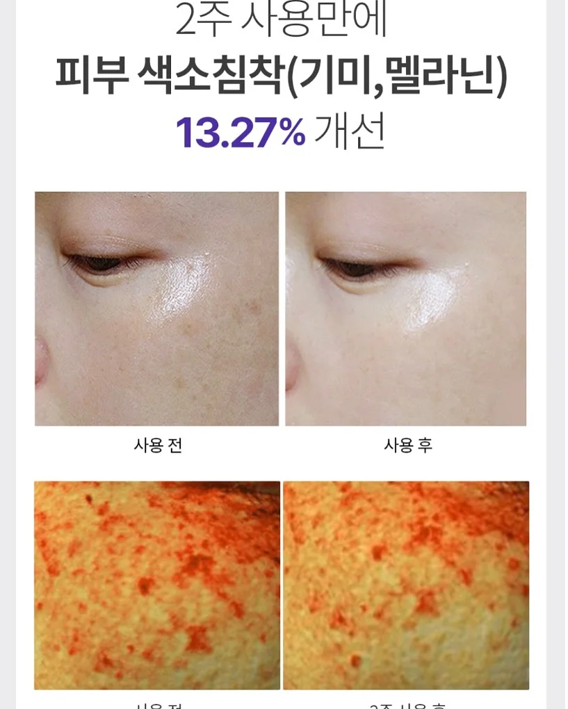총관리 템 6