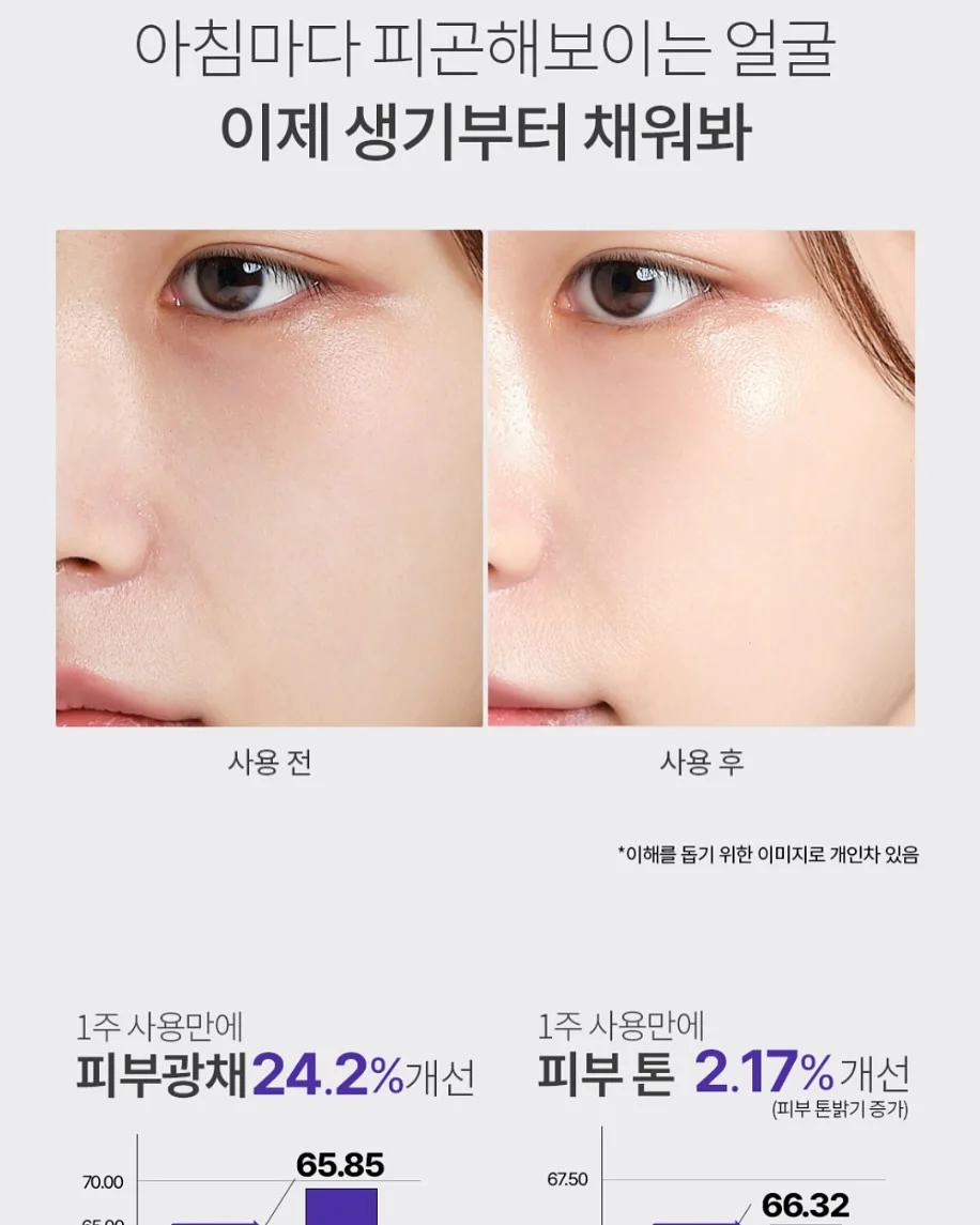 총관리 템 7