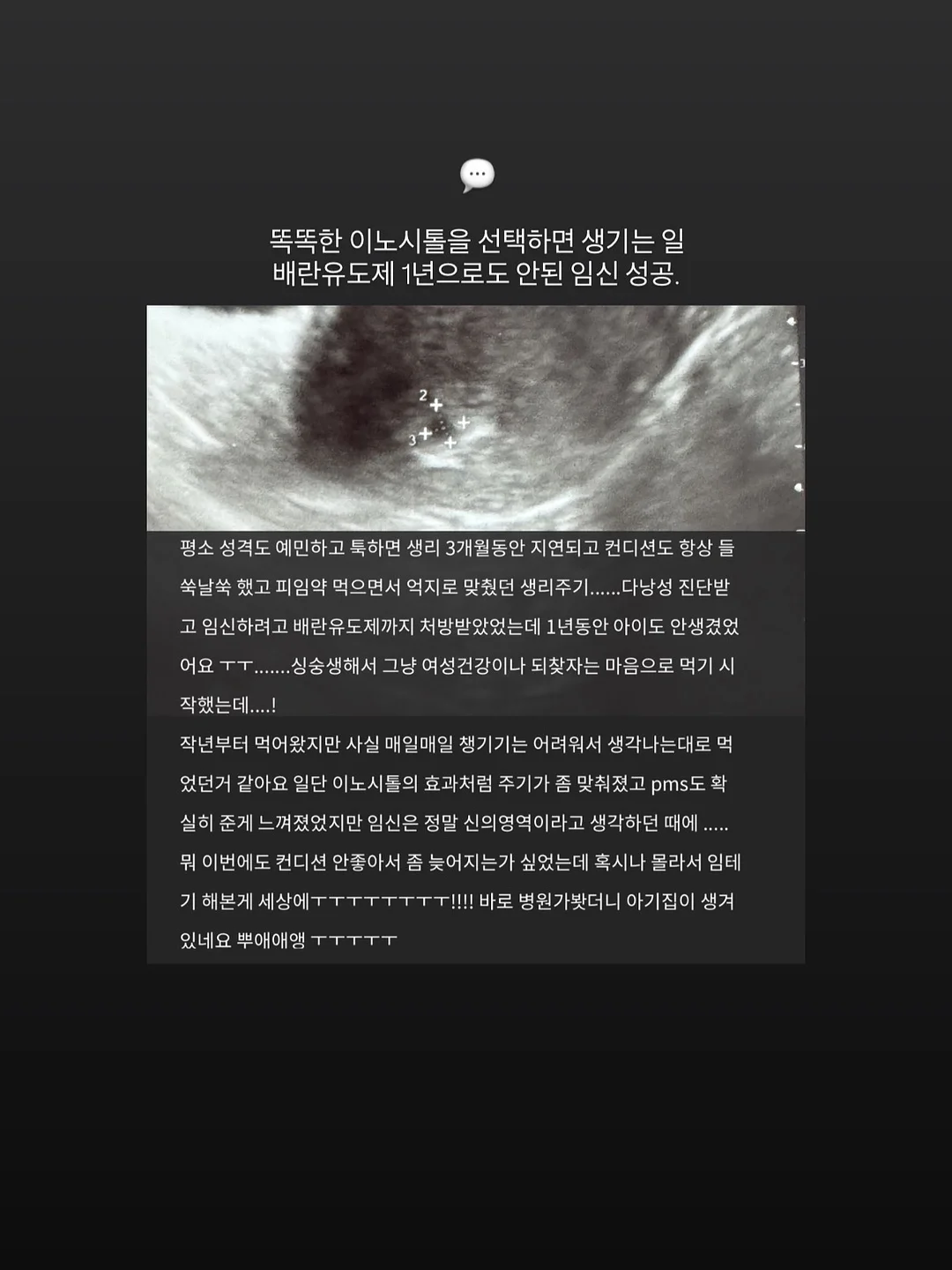 성냥 15