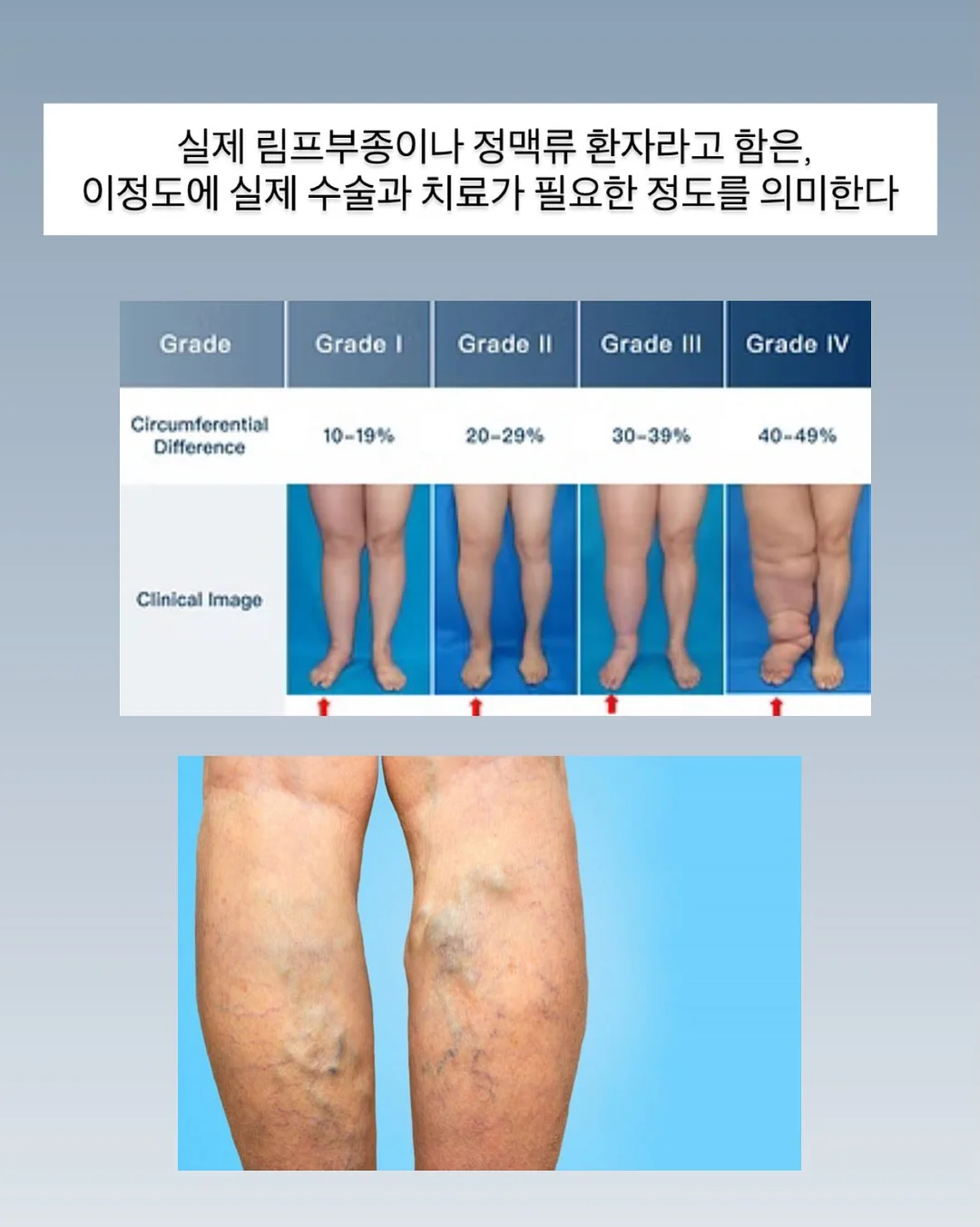 구달 맑은 어성초 진정 수분 선크림 15