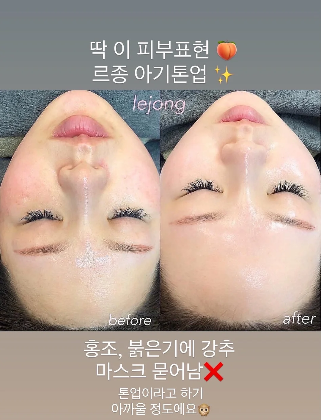 청매실피클 12