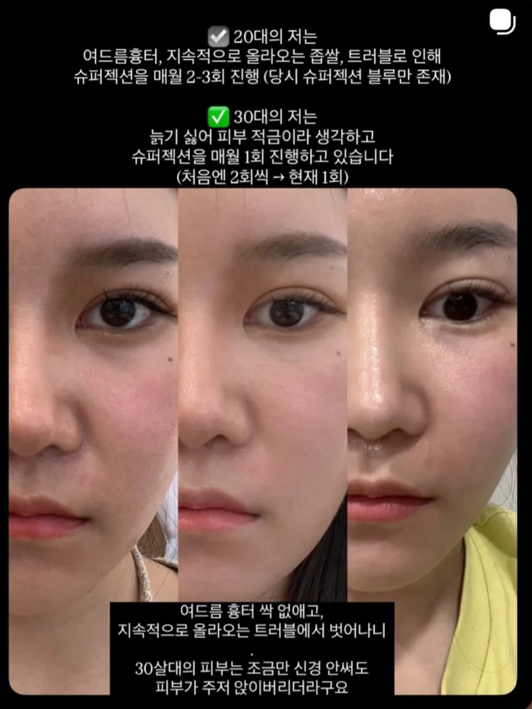 비아노 소가죽가방 2