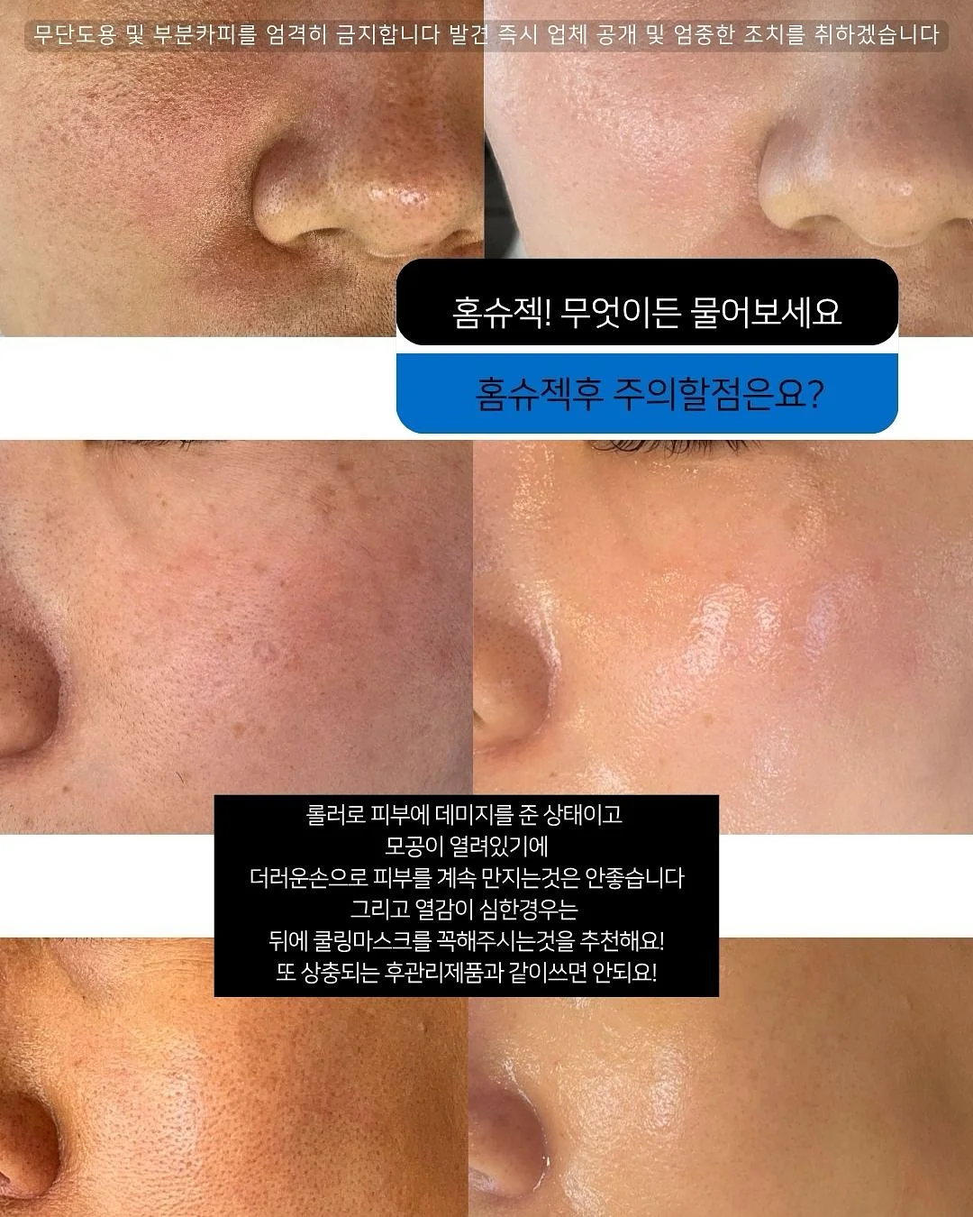 전동 블라인드 13