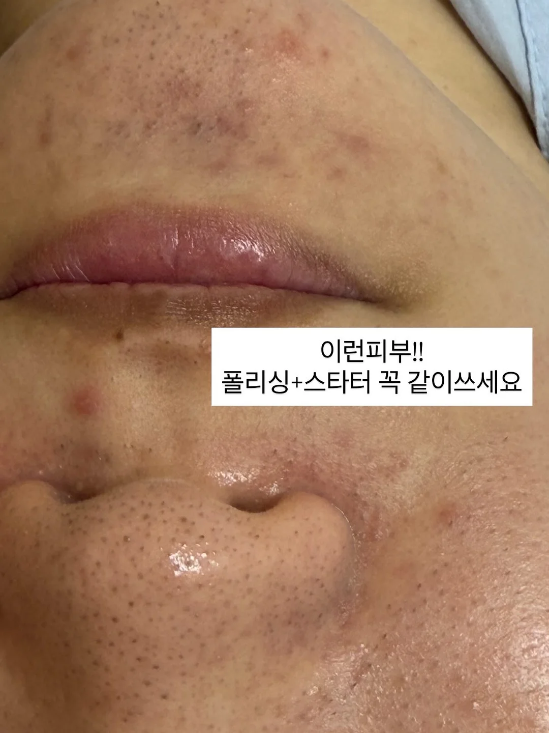 크리스탈 꽃잎 슈즈 9