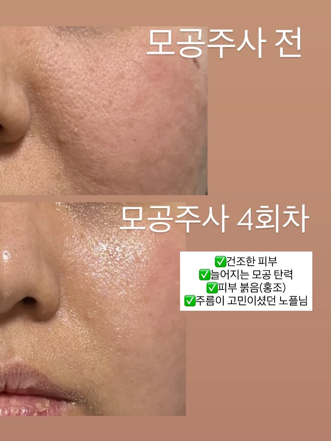 해녀 컨셉 촬영 9