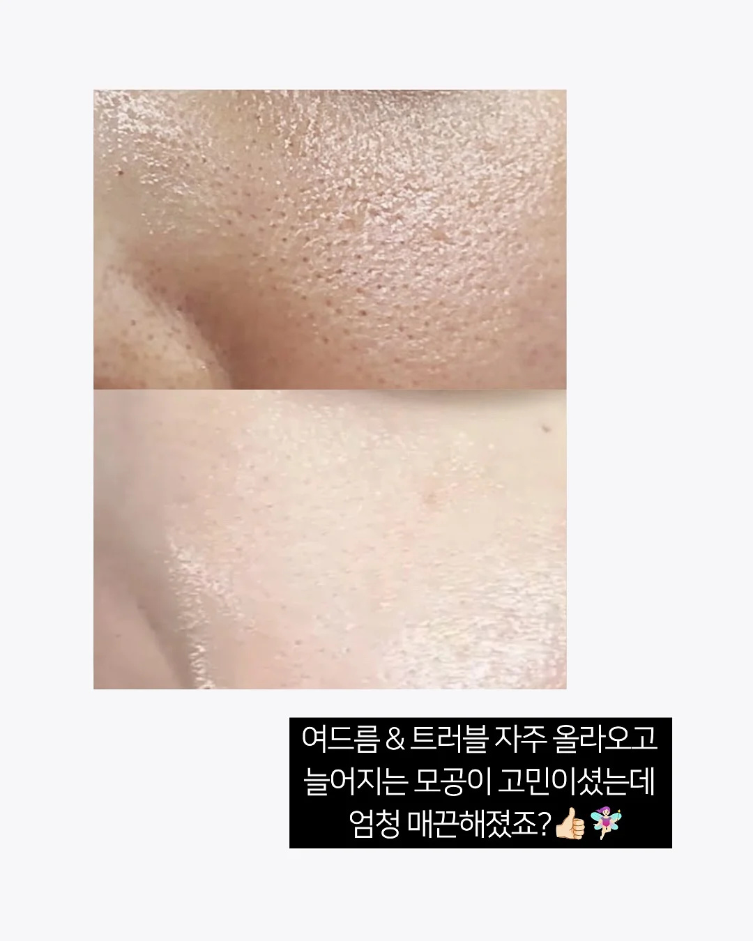 에이프런과 블랭킷 세트 2