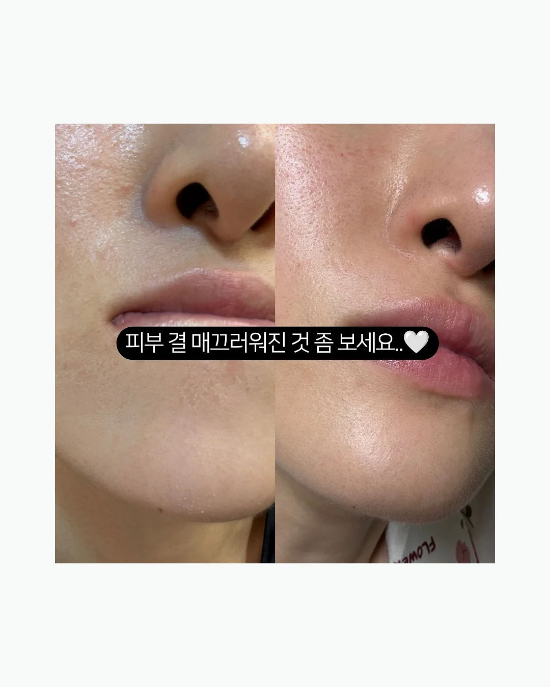 에이프런과 블랭킷 세트 3