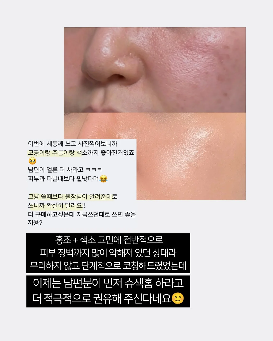 에이프런과 블랭킷 세트 4