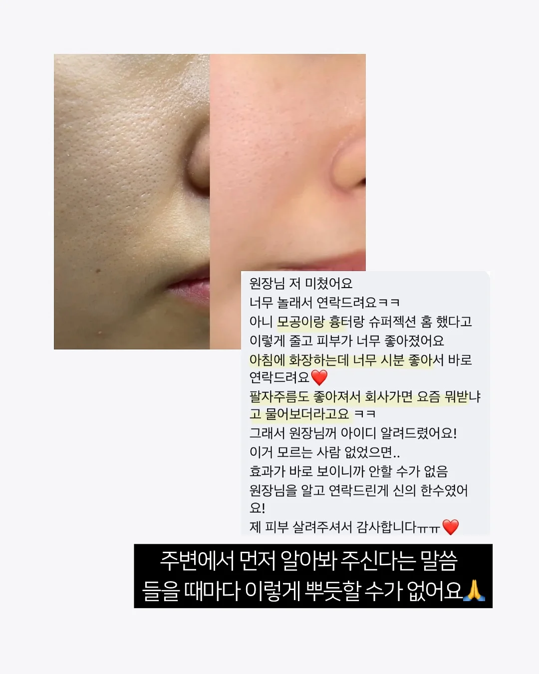에이프런과 블랭킷 세트 5