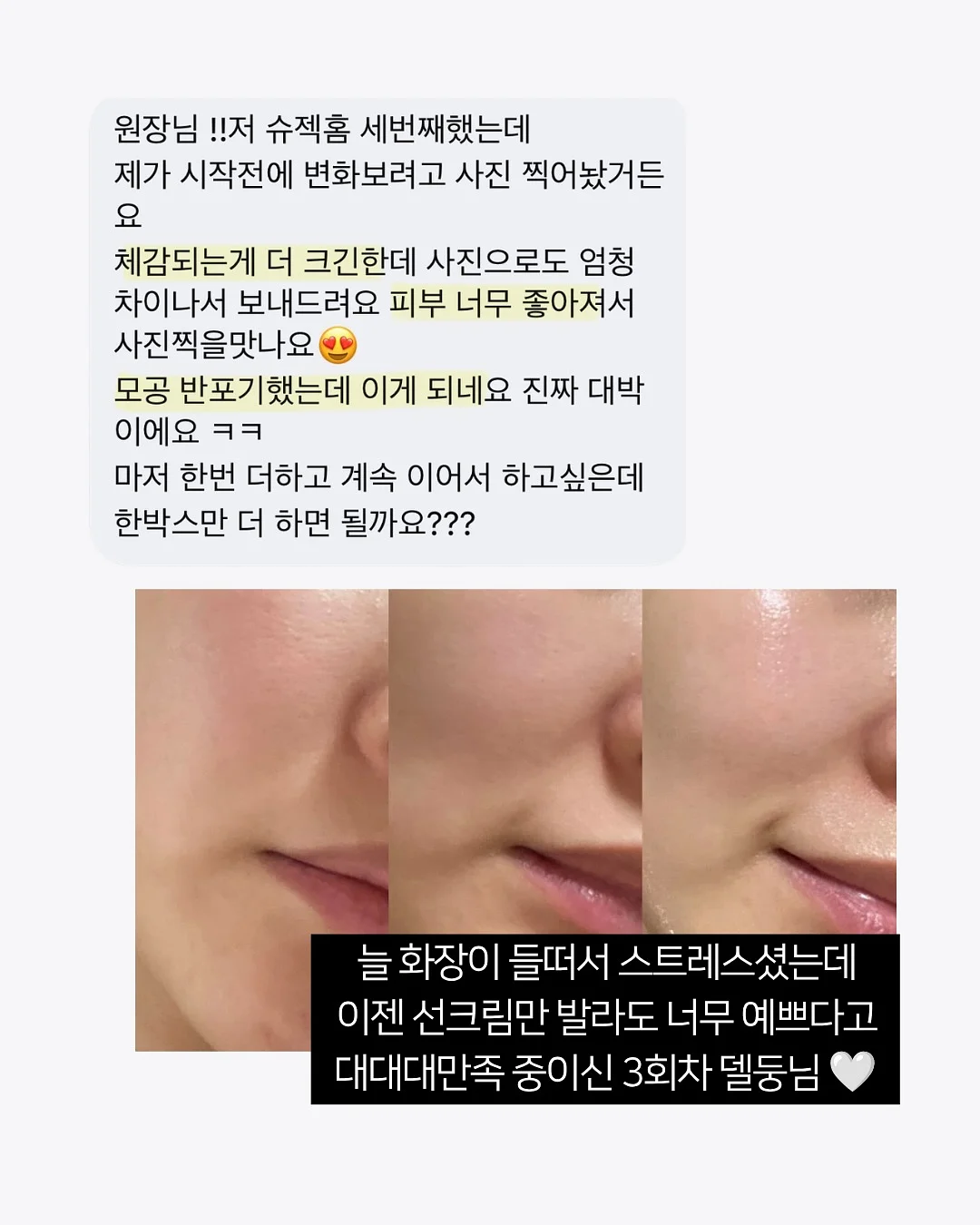 에이프런과 블랭킷 세트 6