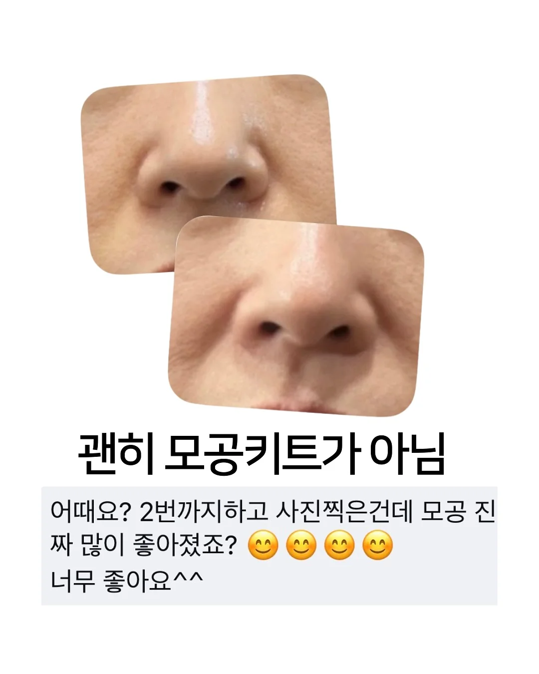 에이프런과 블랭킷 세트 7