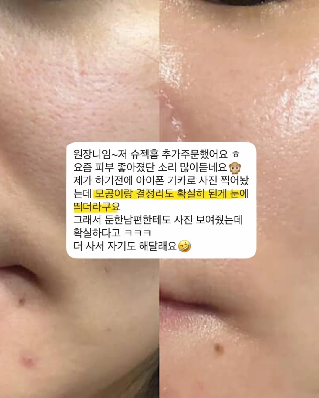 에이프런과 블랭킷 세트 8