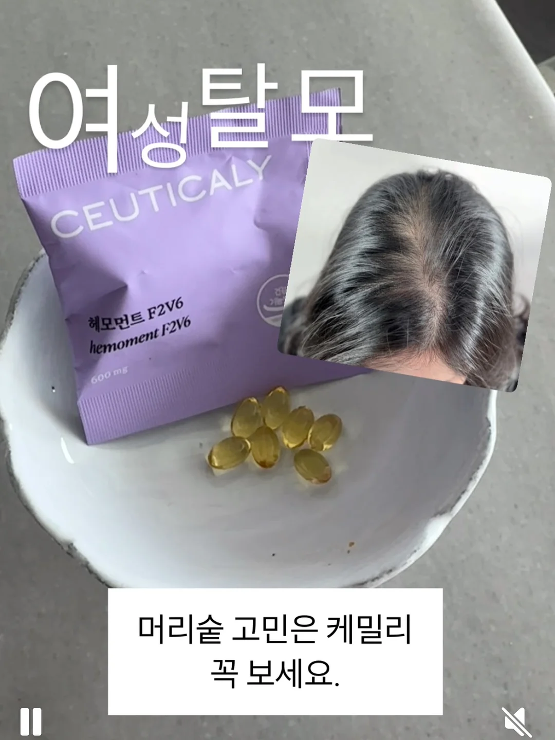 잡곡밥 한 스푼 1