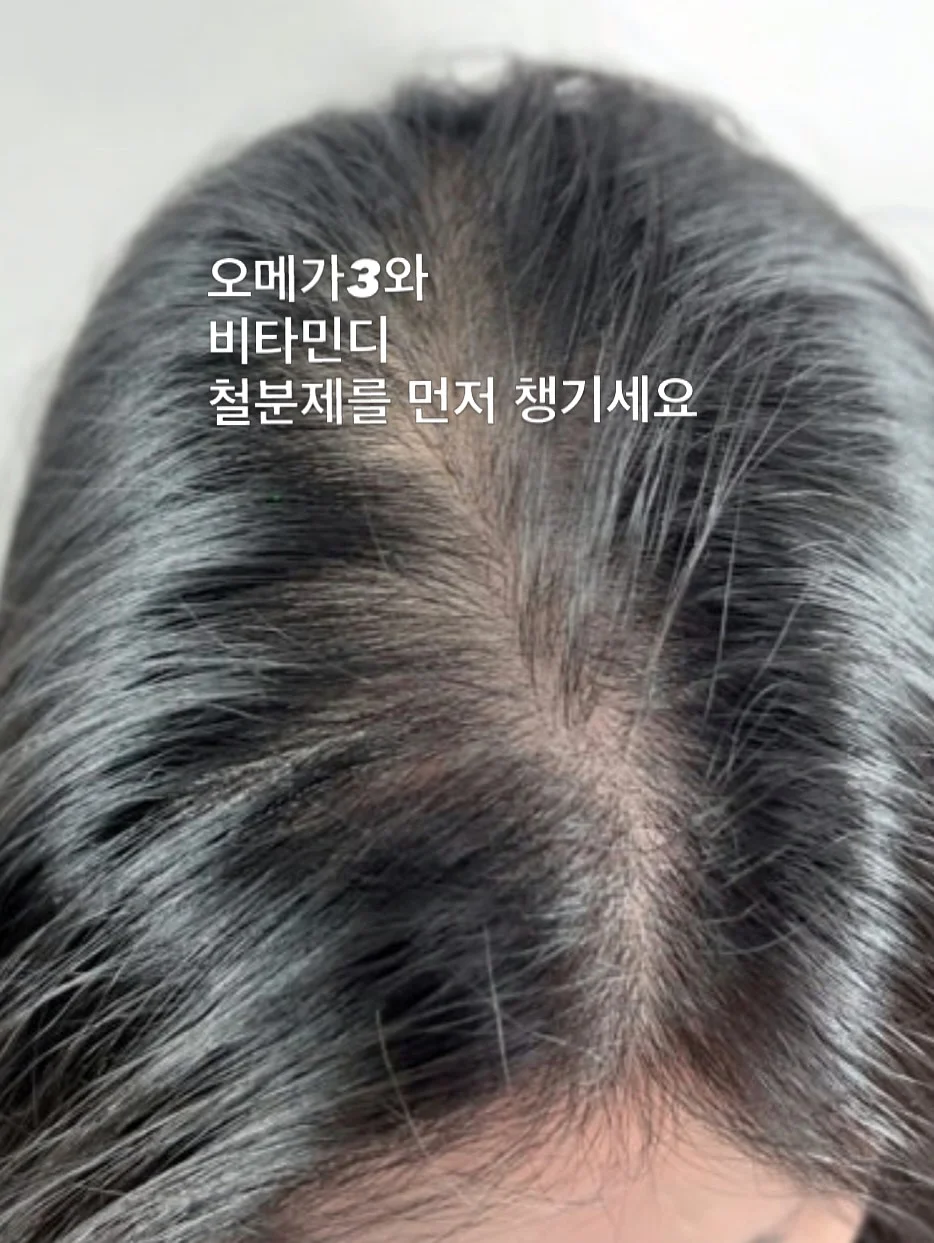 잡곡밥 한 스푼 10