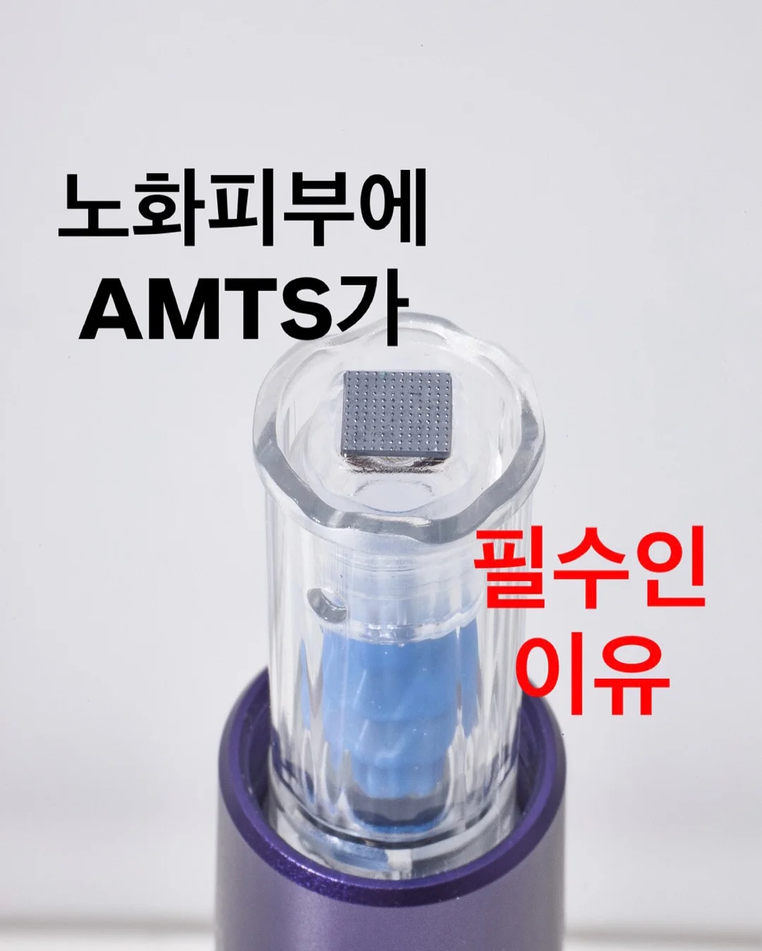 시카겔 1