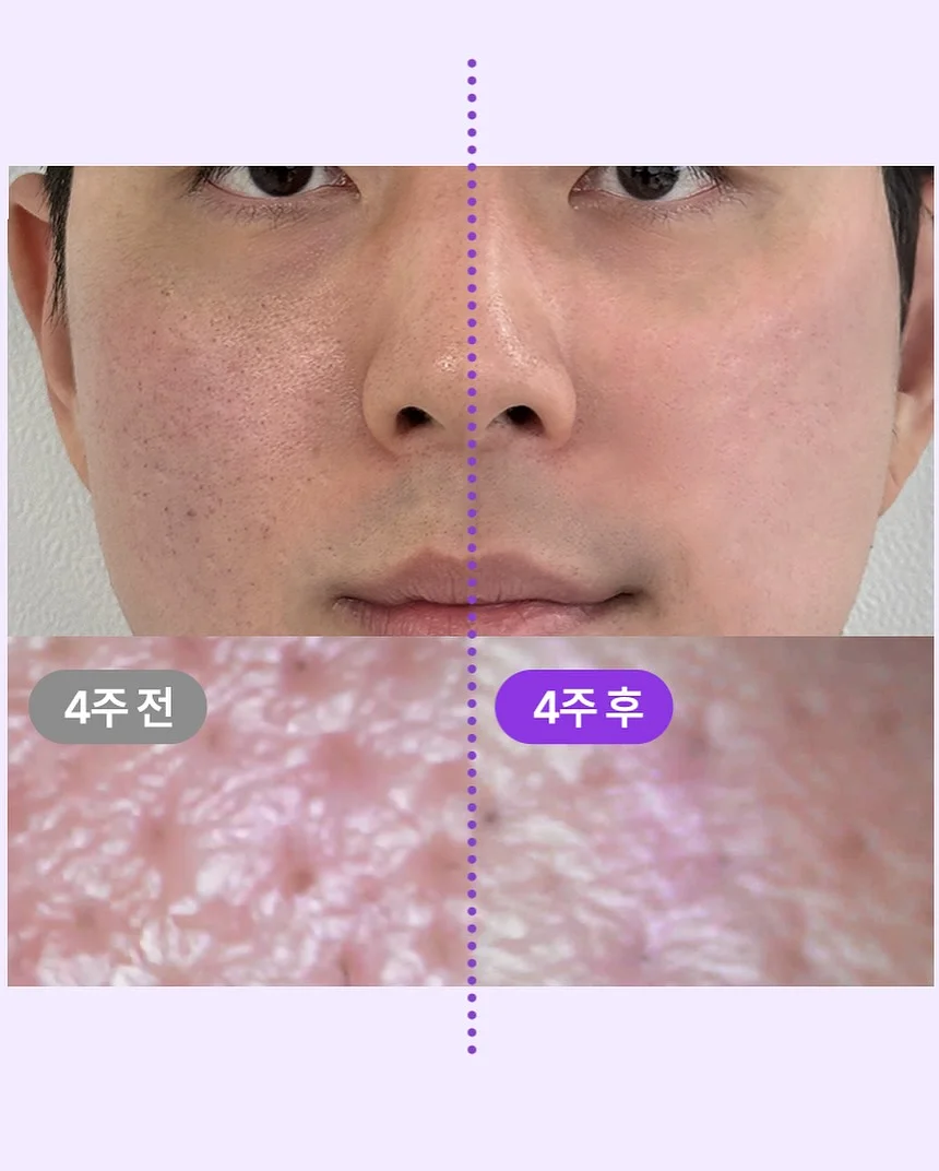 시카겔 7