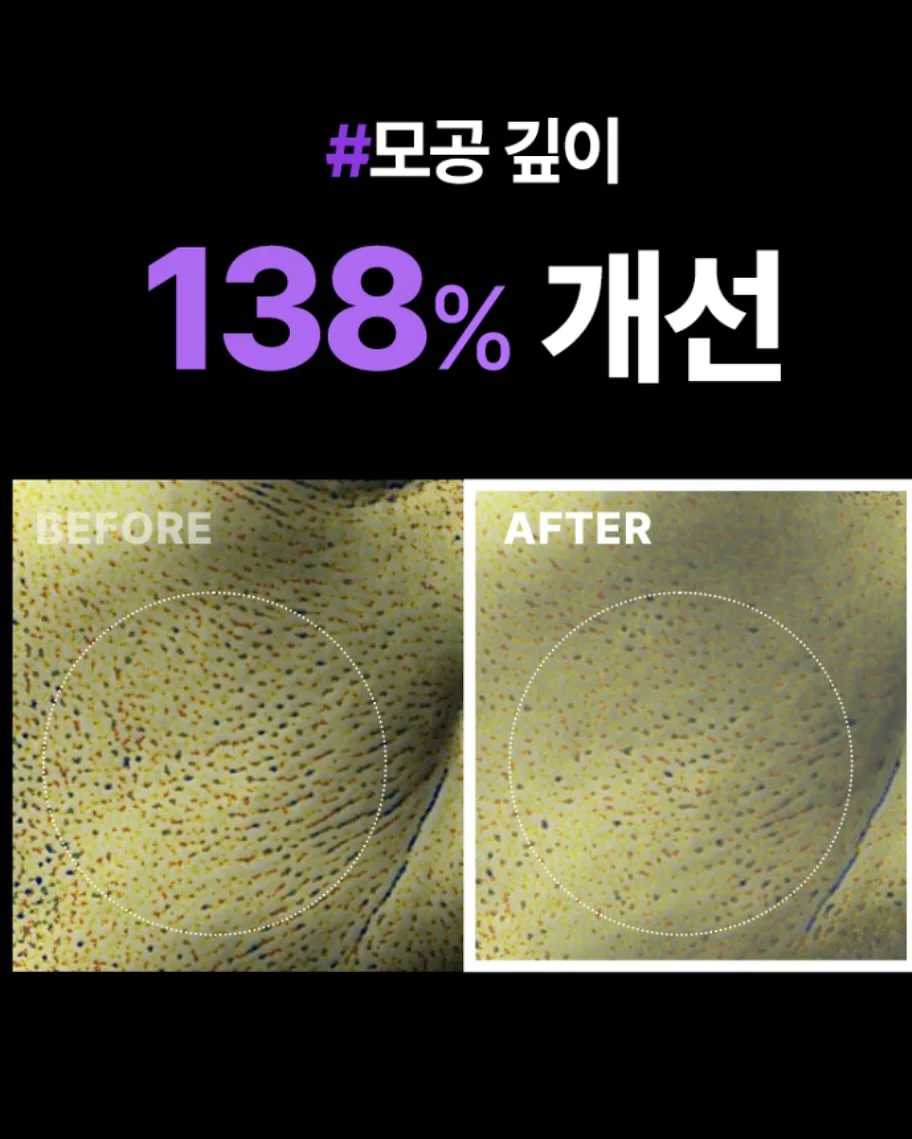 시카겔 8